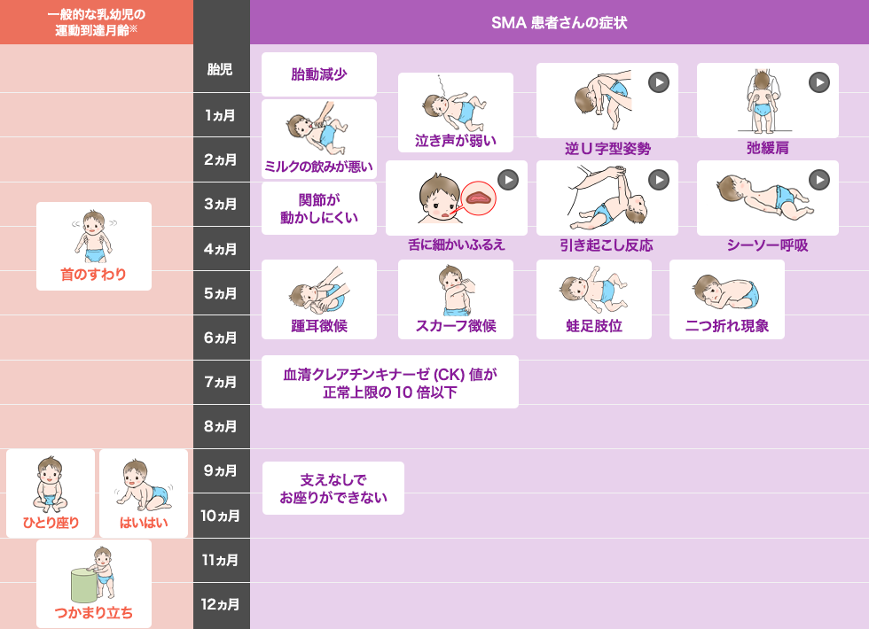 一般的な乳幼児の運動到達月齢とⅠ型SMA患者さんの各症状の発症時期